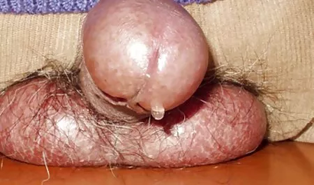 Chị mỗi âm đạo phin sét nhật